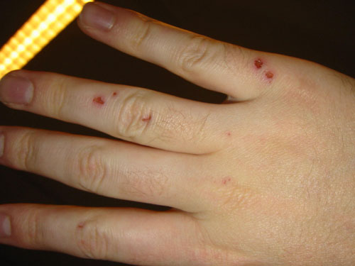 [ Hand update ]